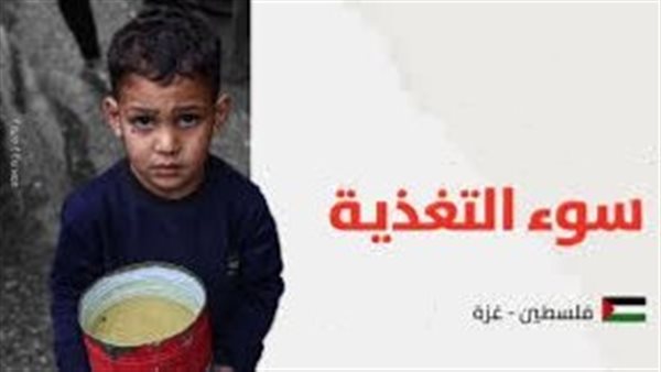 انتشار سوء التغذية